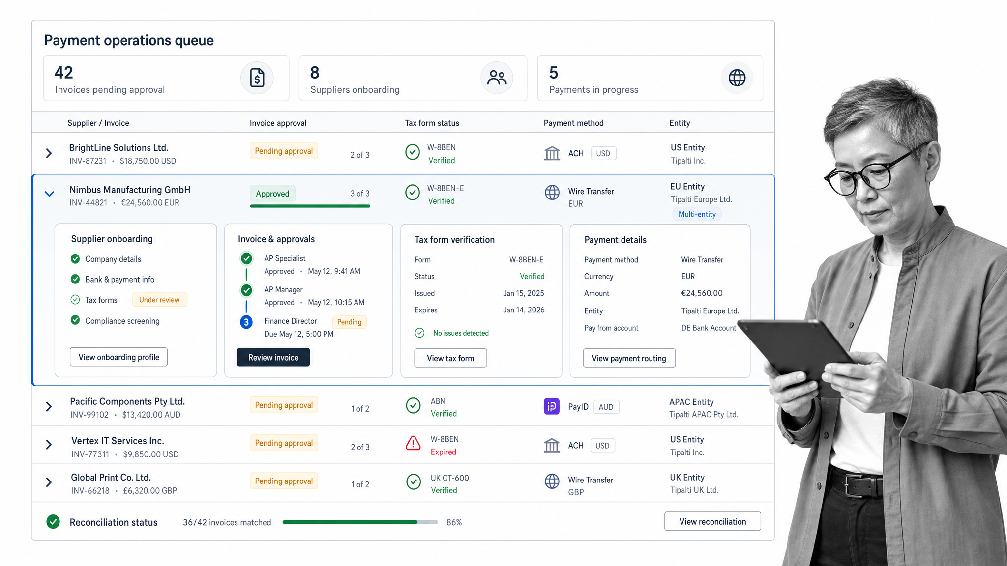 Tipalti accounts payable automation screen for supplier onboarding and payments.